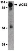 Anti-ACE2 antibody produced in rabbit affinity isolated antibody