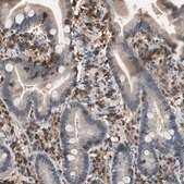 Anti-NFATC2 antibody produced in rabbit Prestige Antibodies® Powered by Atlas Antibodies, affinity isolated antibody, buffered aqueous glycerol solution