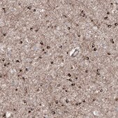 Anti-APAF1 antibody produced in rabbit Prestige Antibodies® Powered by Atlas Antibodies, affinity isolated antibody, buffered aqueous glycerol solution