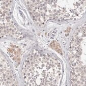 Anti-DOPEY1 antibody produced in rabbit Prestige Antibodies® Powered by Atlas Antibodies, affinity isolated antibody, buffered aqueous glycerol solution, ab1