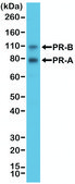 Anti-PR (Progesterone Receptor) antibody, Rabbit monoclonal recombinant, expressed in HEK 293 cells, clone RM357, purified immunoglobulin