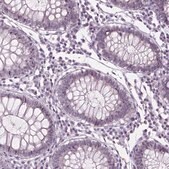 Anti-CDKN1C antibody produced in rabbit Prestige Antibodies® Powered by Atlas Antibodies, affinity isolated antibody, buffered aqueous glycerol solution