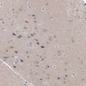 Anti-FOXO1 antibody produced in rabbit Prestige Antibodies® Powered by Atlas Antibodies, affinity isolated antibody, buffered aqueous glycerol solution