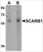 Anti-SCARB1 antibody produced in rabbit affinity isolated antibody, buffered aqueous solution