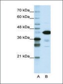 Anti-TARDBP (AB1) antibody produced in rabbit IgG fraction of antiserum