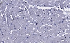 Anti-RHOT1/MIRO-1 Antibody, clone 1F4 ZooMAb® Rabbit Monoclonal recombinant, expressed in HEK 293 cells