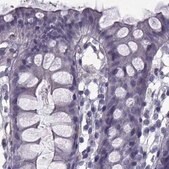 Anti-CALCR antibody produced in rabbit Prestige Antibodies® Powered by Atlas Antibodies, affinity isolated antibody
