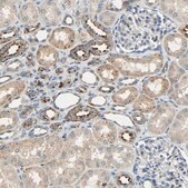 Anti-ASAH1 antibody produced in rabbit Prestige Antibodies® Powered by Atlas Antibodies, affinity isolated antibody, buffered aqueous glycerol solution