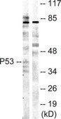 Anti-p53 antibody produced in rabbit affinity isolated antibody