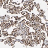 Anti-MYO1C antibody produced in rabbit Prestige Antibodies® Powered by Atlas Antibodies, affinity isolated antibody, buffered aqueous glycerol solution