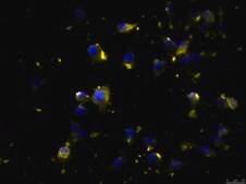 OSUMMER.3 Mouse NRAS-Mutant Melanoma Cell Line