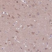 Anti-RASD1 antibody produced in rabbit Prestige Antibodies® Powered by Atlas Antibodies, affinity isolated antibody, buffered aqueous glycerol solution