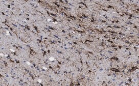 抗-GFAP抗体，克隆2E8，ZooMAb®兔单克隆抗体 recombinant, expressed in HEK 293 cells