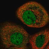 Anti-MAPKAP1 antibody produced in rabbit Prestige Antibodies® Powered by Atlas Antibodies, affinity isolated antibody, buffered aqueous glycerol solution, ab1