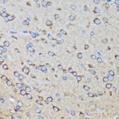 Anti-RALBP1 Antibody, clone 5C10W9, Rabbit Monoclonal