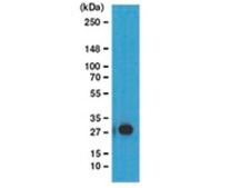 ChIPAb+ 泛素化组蛋白H2B - ChIP验证的抗体和引物组 clone 56, from mouse, purified by using protein G