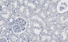 Anti-XIAP Antibody, clone 3H4 ZooMAb® Rabbit Monoclonal recombinant, expressed in HEK 293 cells