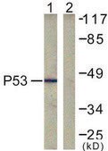 Anti-p53 antibody produced in rabbit affinity isolated antibody