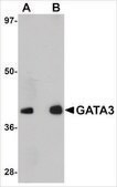 Anti-GATA3 antibody produced in rabbit affinity isolated antibody, buffered aqueous solution