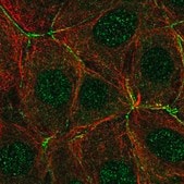 Anti-PAK4 antibody produced in rabbit Prestige Antibodies® Powered by Atlas Antibodies, affinity isolated antibody