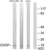 抗-CHOP，N端子 兔抗 affinity isolated antibody