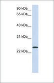 Anti-ARF1 antibody produced in rabbit affinity isolated antibody