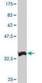 Monoclonal Anti-XBP1 antibody produced in mouse clone 3F5, purified immunoglobulin, buffered aqueous solution