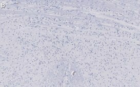 Anti-Calretinin Antibody, clone 6B8.2 ZooMAb® Mouse Monoclonal recombinant, expressed in HEK 293 cells