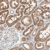 Anti-USP2 antibody produced in rabbit Prestige Antibodies® Powered by Atlas Antibodies, affinity isolated antibody, buffered aqueous glycerol solution