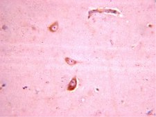 抗谷氨酸受体4抗体 Chemicon®, from rabbit