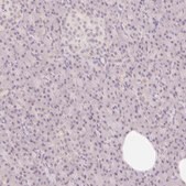 Anti-CASKIN1 antibody produced in rabbit Prestige Antibodies® Powered by Atlas Antibodies, affinity isolated antibody, buffered aqueous glycerol solution