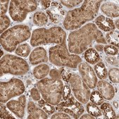 Anti-BAD antibody produced in rabbit Prestige Antibodies® Powered by Atlas Antibodies, affinity isolated antibody, buffered aqueous glycerol solution