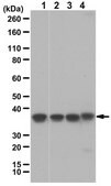 Anti-60S RPL5 from rabbit, purified by affinity chromatography