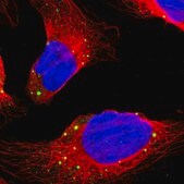 Anti-DCP1A antibody produced in rabbit affinity isolated antibody, buffered aqueous glycerol solution