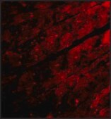 Anti-TRPC3 (ab3) antibody produced in rabbit affinity isolated antibody, buffered aqueous solution