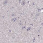 Anti-CALCR antibody produced in rabbit Prestige Antibodies® Powered by Atlas Antibodies, affinity isolated antibody