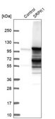 Anti-SRPK1 antibody produced in rabbit Prestige Antibodies® Powered by Atlas Antibodies, affinity isolated antibody, buffered aqueous glycerol solution