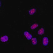 Anti-monomethyl-Histone H3 (Lys4) Antibody Upstate®, from rabbit