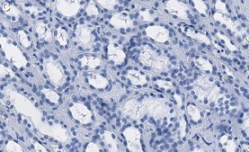 Anti-ACC1 Antibody, clone 1J8 ZooMAb® Rabbit Monoclonal recombinant, expressed in HEK 293 cells