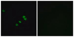 Anti-SP1 antibody produced in rabbit affinity isolated antibody