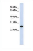 Anti-IL33 antibody produced in rabbit affinity isolated antibody