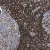 Anti-ANXA6 antibody produced in rabbit Prestige Antibodies® Powered by Atlas Antibodies, affinity isolated antibody, buffered aqueous glycerol solution