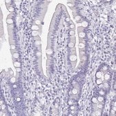 Anti-SYCP3 antibody produced in rabbit Prestige Antibodies® Powered by Atlas Antibodies, affinity isolated antibody, buffered aqueous glycerol solution