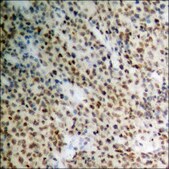 Anti-phospho-STAT2 (pTyr690) antibody produced in rabbit affinity isolated antibody