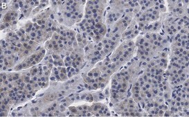Anti-CXCR4 Antibody, clone 2L2, ZooMAb® Rabbit Monoclonal recombinant, expressed in HEK 293 cells