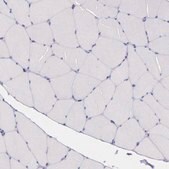 抗 THSD7A 兔抗 Prestige Antibodies® Powered by Atlas Antibodies, affinity isolated antibody, buffered aqueous glycerol solution