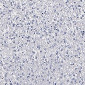 Anti-FABP4 antibody produced in rabbit Prestige Antibodies® Powered by Atlas Antibodies, affinity isolated antibody, buffered aqueous glycerol solution