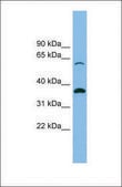 Anti-SLC25A4 affinity isolated antibody
