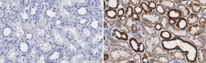 Anti-VDAC1 Antibody, clone 3M22, ZooMAb® Rabbit Monoclonal recombinant, expressed in HEK 293 cells