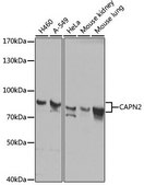 Anti-CAPN2 antibody produced in rabbit